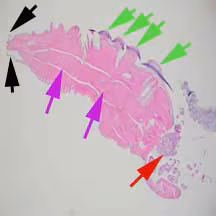 parasitic image answer