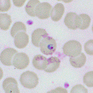 parasitic image