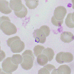 parasitic image