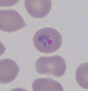 Parasitic image