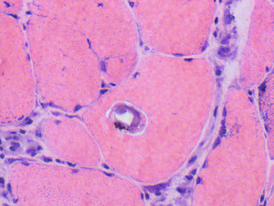Parasitic image