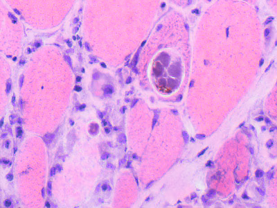 Parasitic image