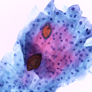Parasitic image