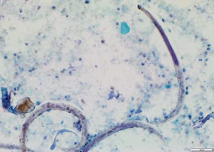 parasitic image