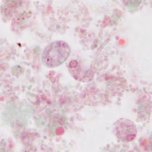 parasitic image
