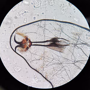parasitic image