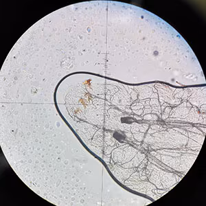 parasitic image