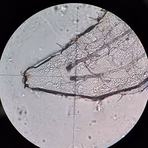 parasitic image