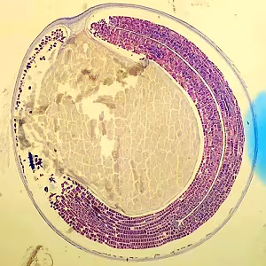 parasitic image
