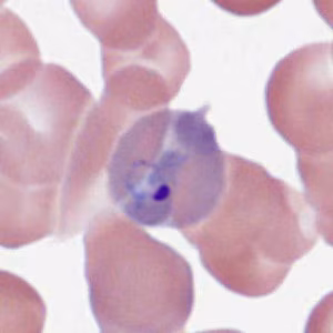 parasitic image