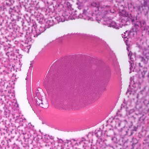 parasitic image