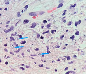 parasitic image