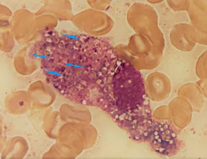 parasitic image