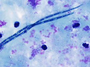 parasitic image