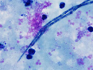 parasitic image