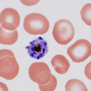 Case485_C Parasitic image
