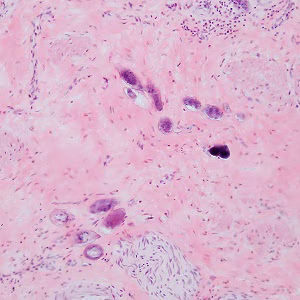 Case487_A parasitic image