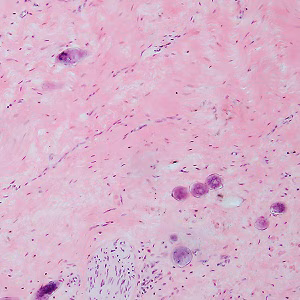 Case487_B parasitic image