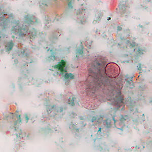 parasitic image