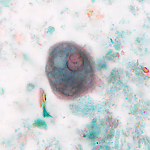 Case488_B parasitic image