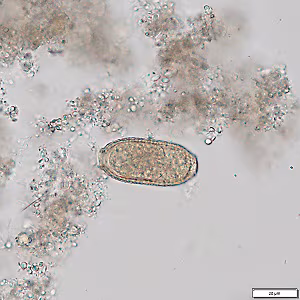 parasitic image