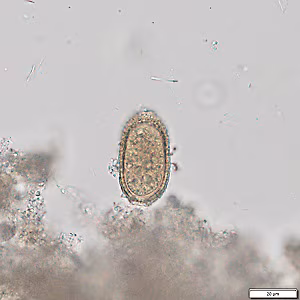 Case492_B Figure B