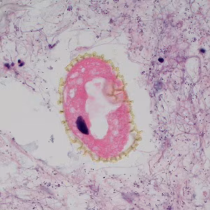 Case495_B Figure B