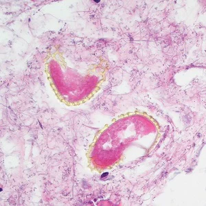 Case495_C Figure C