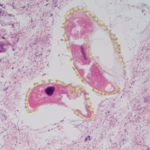 Case495_E Figure E