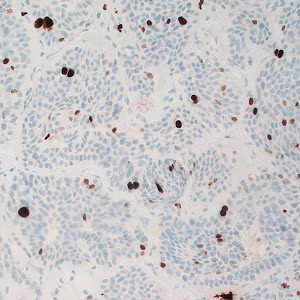 Case495_F Figure F