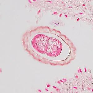 Case495_J Figure J