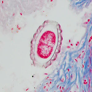 Case495_K Figure K