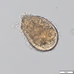 Case496_B Figure B