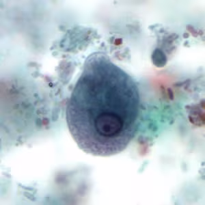 Case497_B Figure B