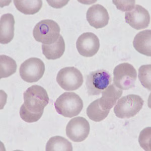 Case499_B Figure B