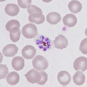 Case499_D Figure D