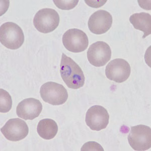 Case499_F Figure F