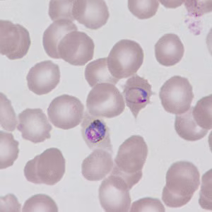 Case499_G Figure G