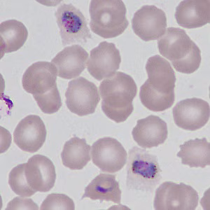 Case499_H Figure H