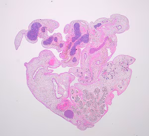 parasitic image