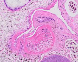 Case501_B Figure B