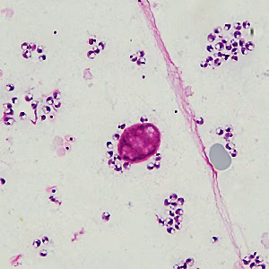 parasitic image