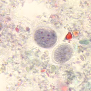 Case_503_C Figure C