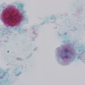 Case_503_D Figure D
