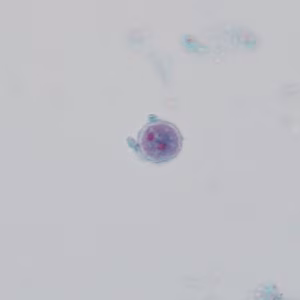 Case_503_E Figure E