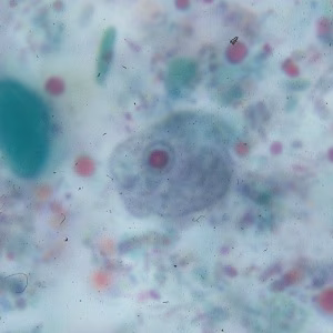 Case_503_F Figure F