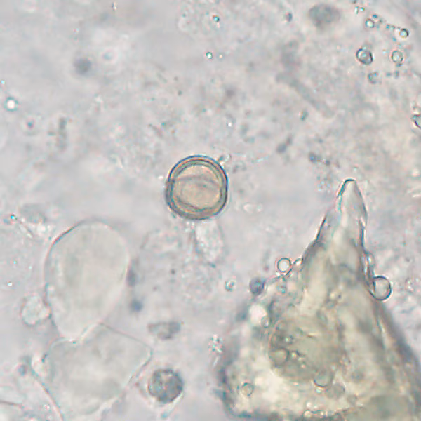 Case527_B Figure B