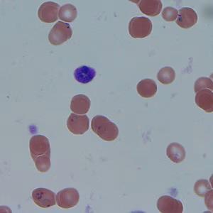 Case_507_D Figure A