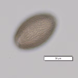 Case_509_B Figure B