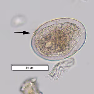 Case_510_D_answer